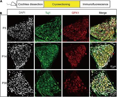 Glutathione Peroxidase 1 Protects Against Peroxynitrite-Induced Spiral Ganglion Neuron Damage Through Attenuating NF-κB Pathway Activation